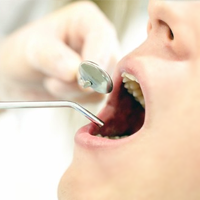 訪問歯科で抜歯は出来る？治療の際の注意点